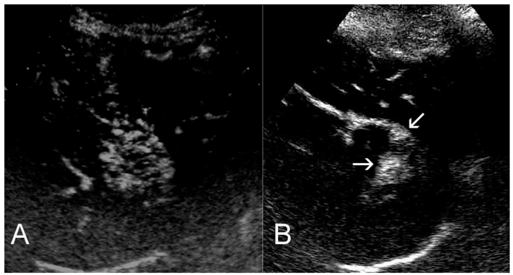 Diagnostics 06 00009 g002 1024