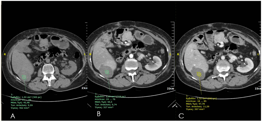 Diagnostics 06 00009 g003 1024