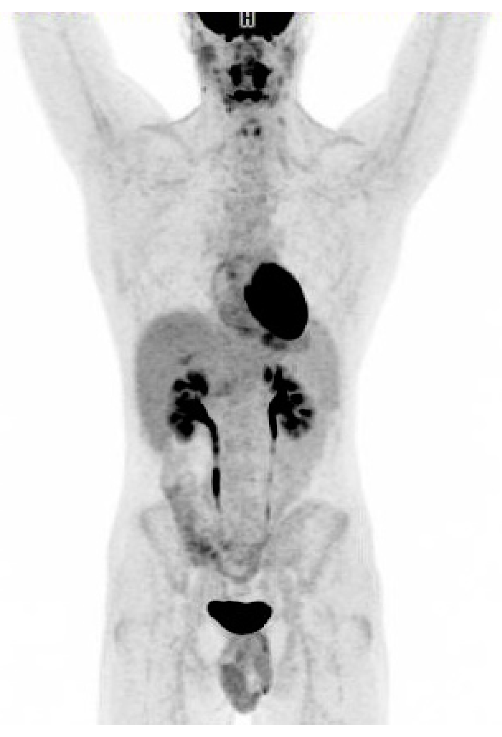 Diagnostics 06 00018 g002 1024