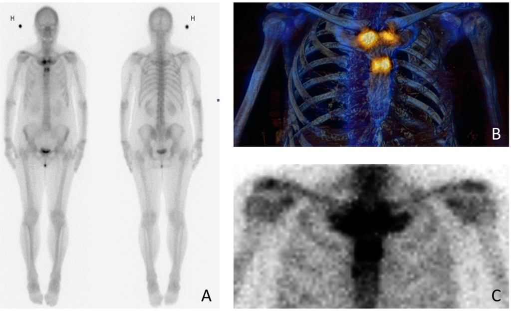 Diagnostics 06 00029 g002 1024