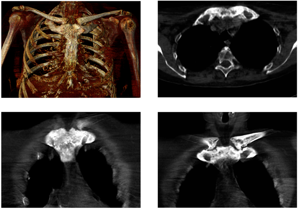 Diagnostics 06 00029 g003 1024