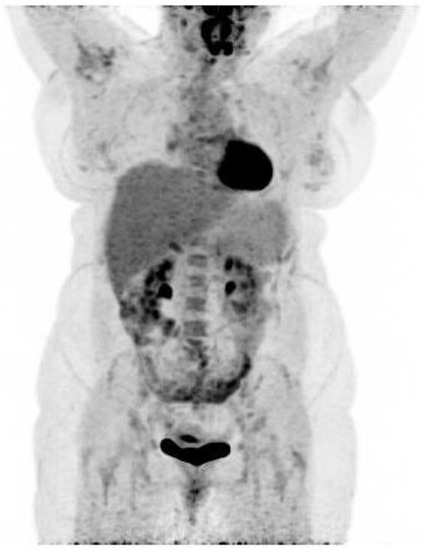 Diagnostics 07 00049 g002 550