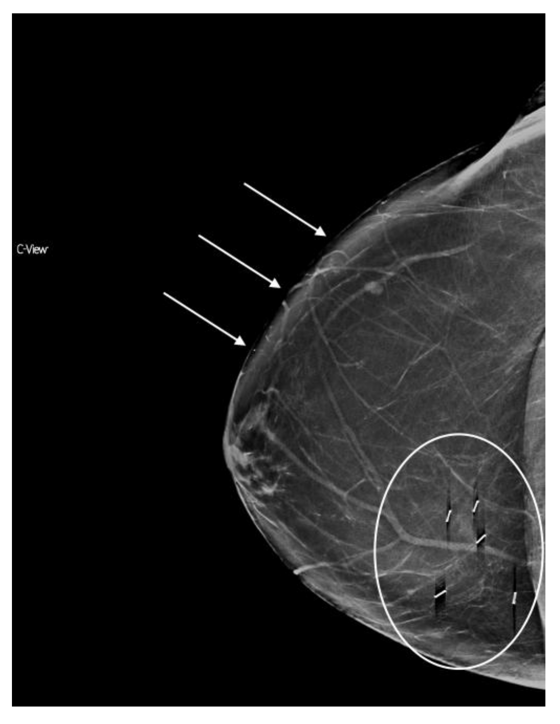 Diagnostics 08 00022 g008