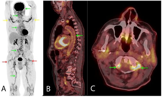 Diagnostics 08 00027 g001 550