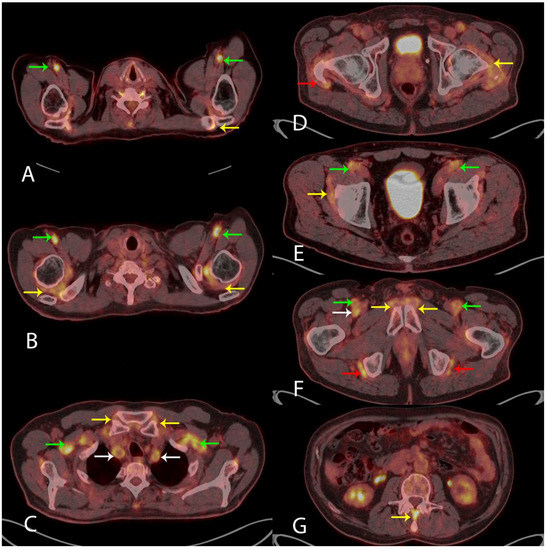 Diagnostics 08 00027 g002 550