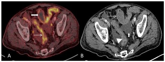 Diagnostics 08 00072 g002