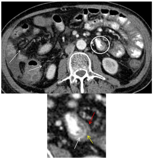 Diagnostics 08 00072 g003