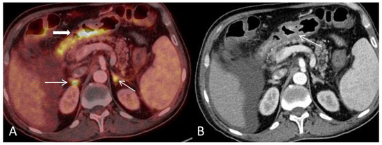 Diagnostics 08 00072 g005