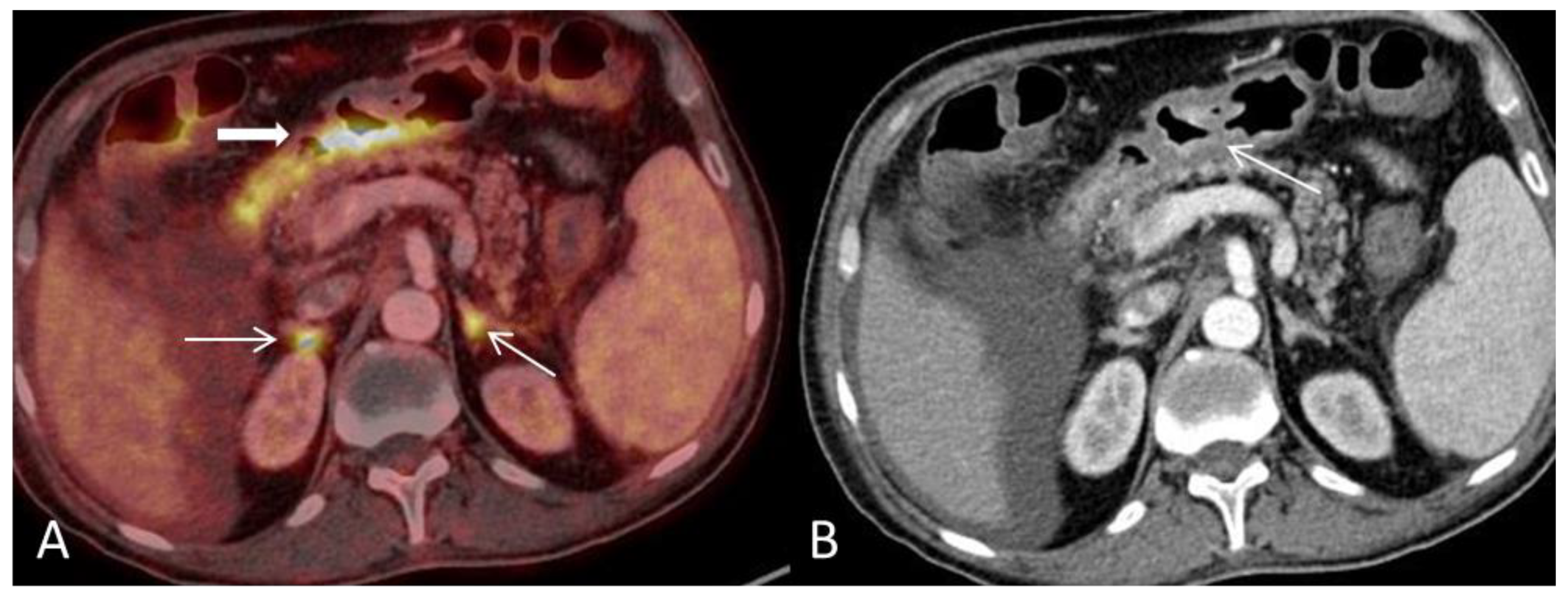 Diagnostics 08 00072 g005