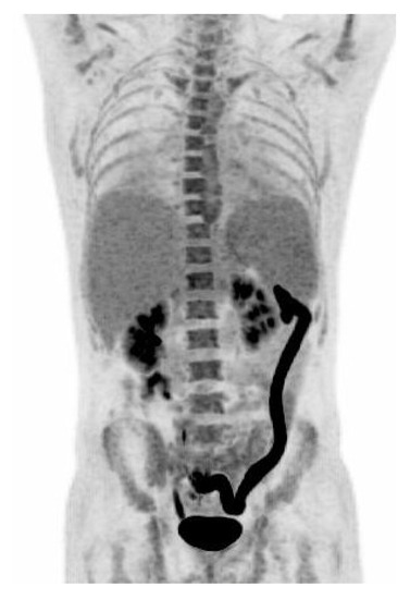 Diagnostics 09 00003 g001 550