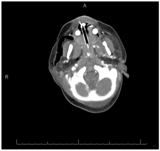 Diagnostics 09 00011 g0a1