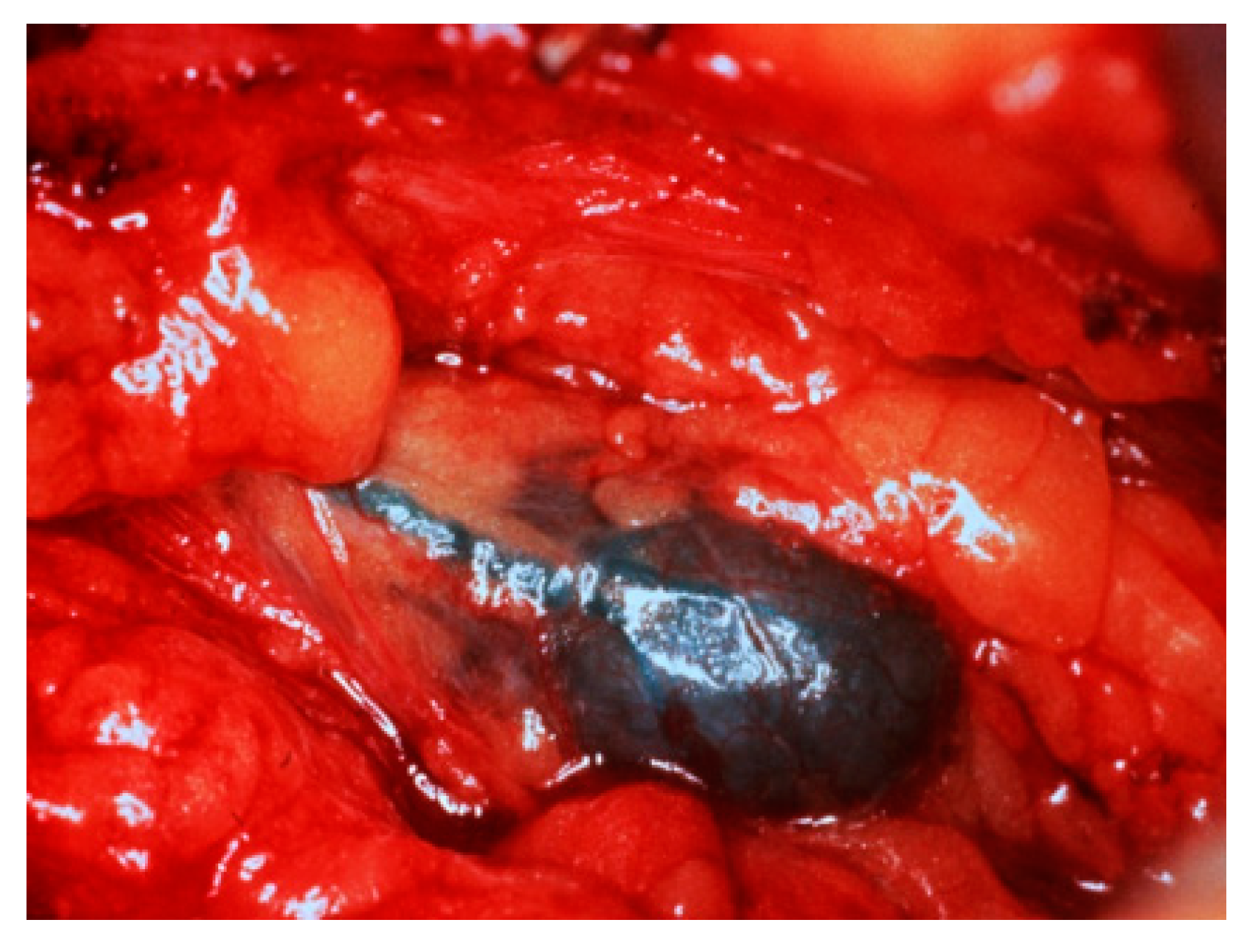 Diagnostics 09 00012 g003