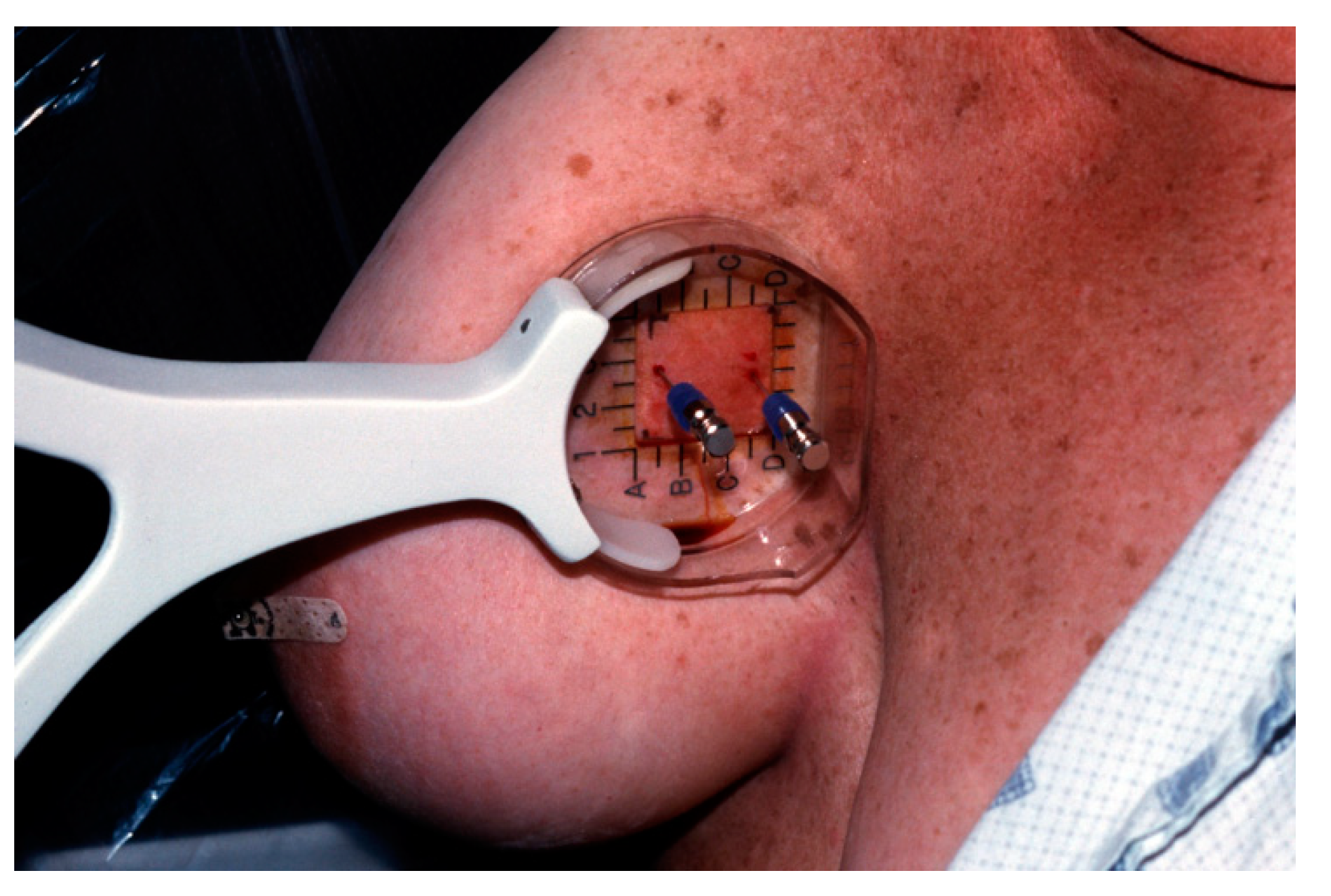 Diagnostics 09 00012 g006