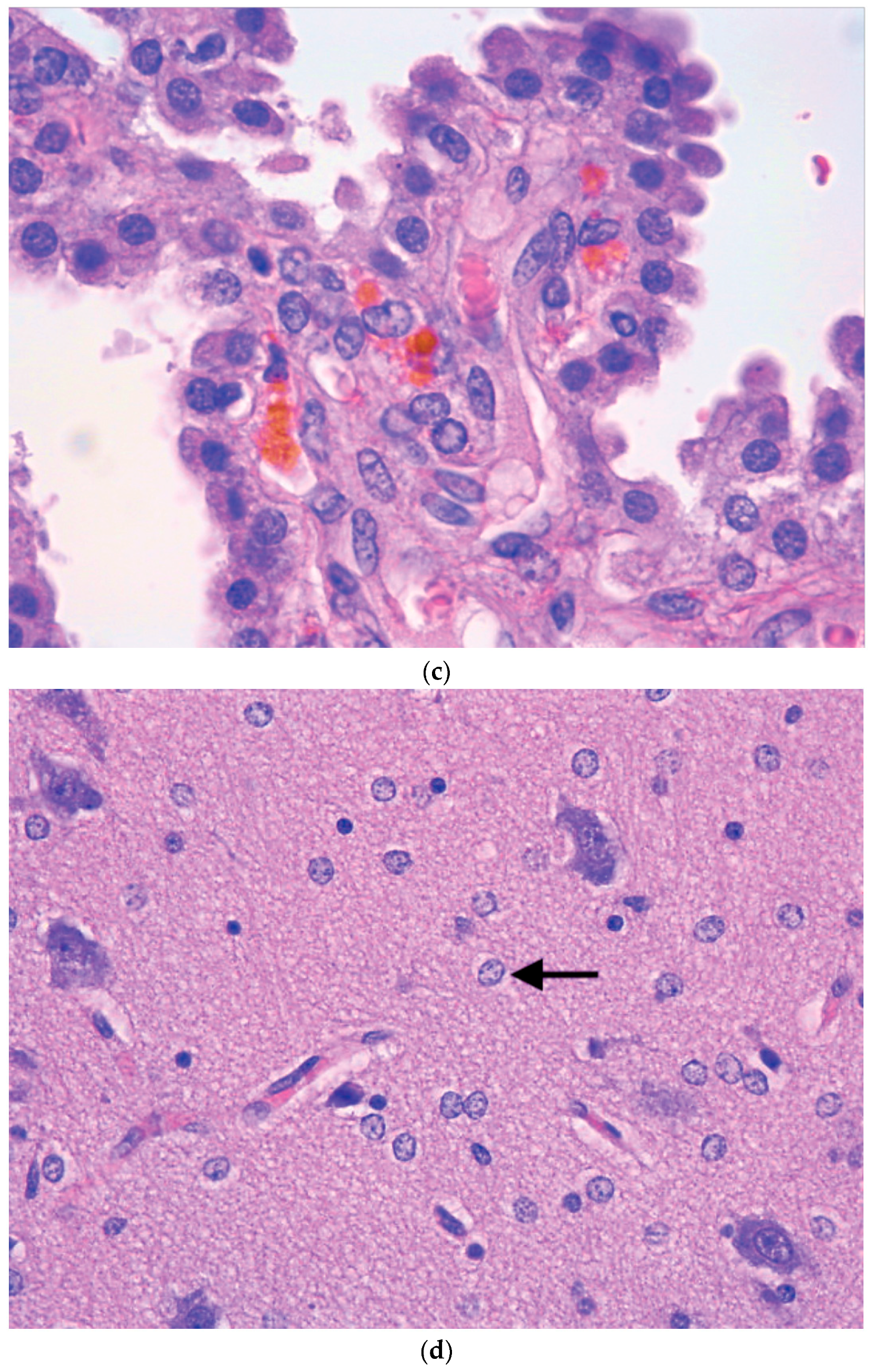 Diagnostics 09 00024 g001b