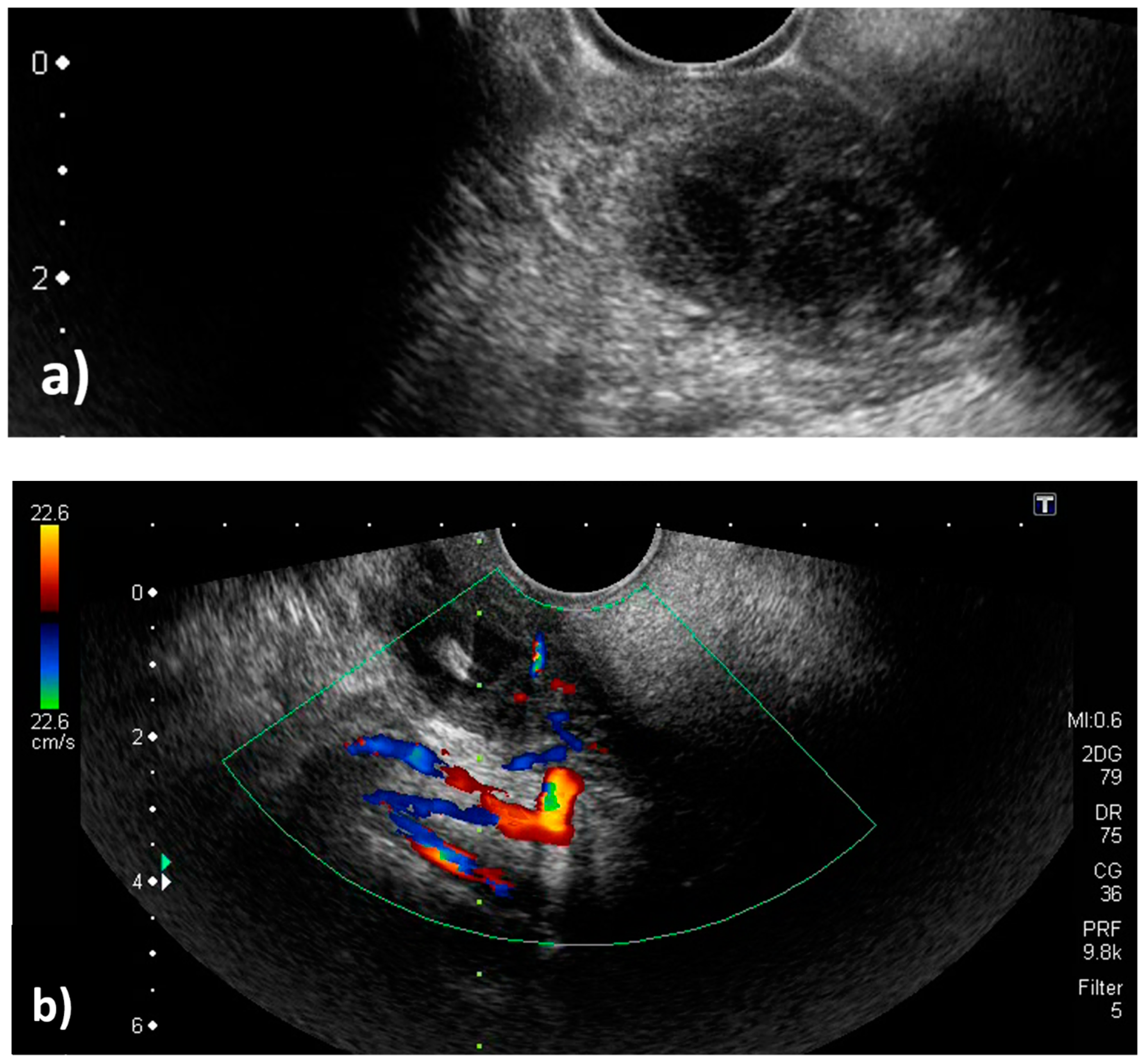 Diagnostics 09 00141 g004a