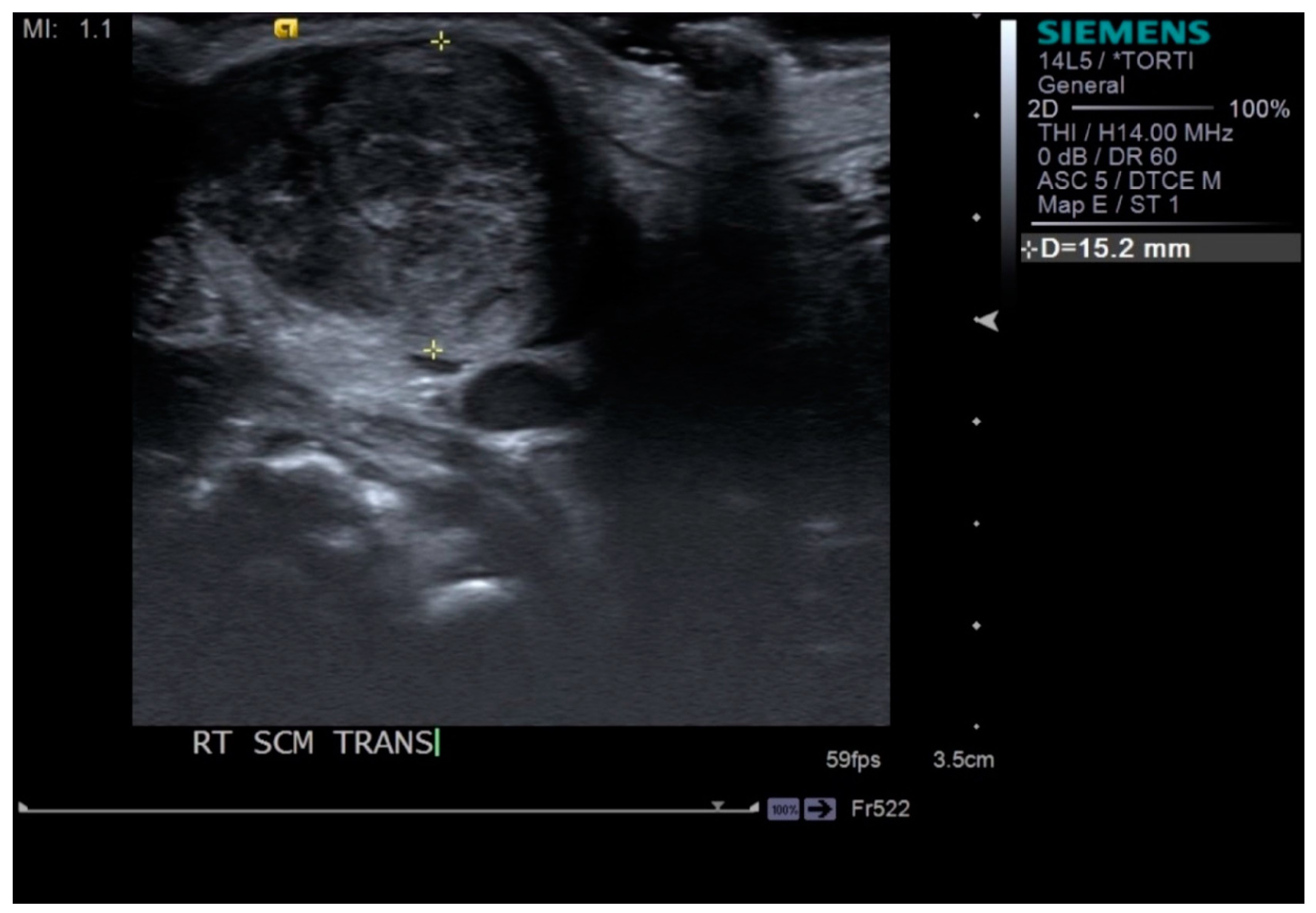 Diagnostics 09 00158 g002 Diagnostics 09 00158 g002