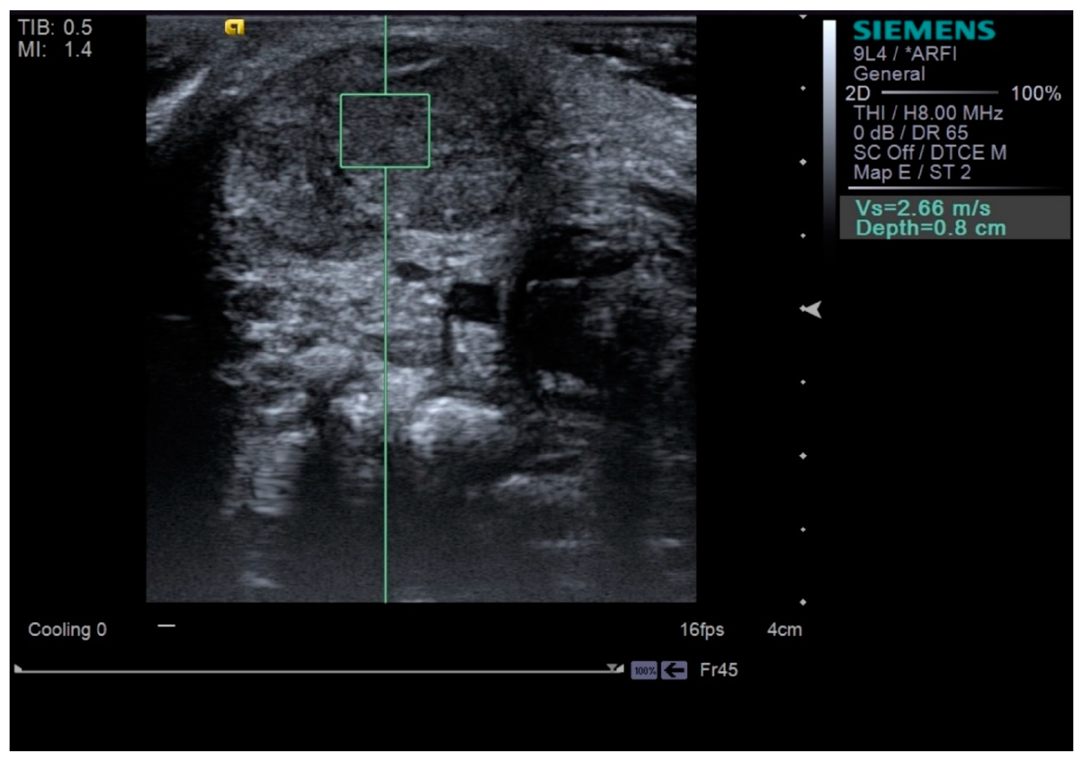 Diagnostics 09 00158 g003 Diagnostics 09 00158 g003
