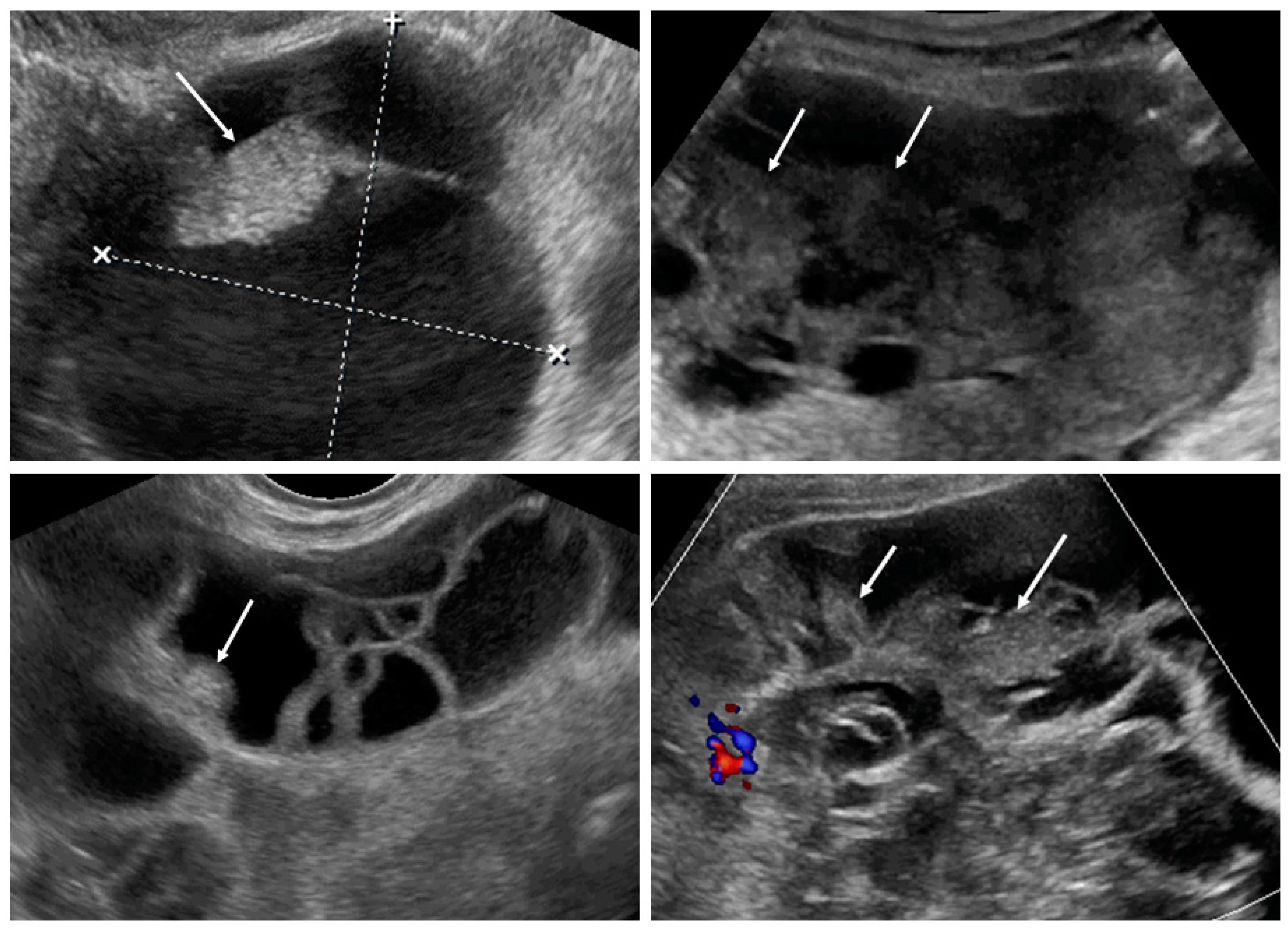 Diagnostics 09 00210 g004