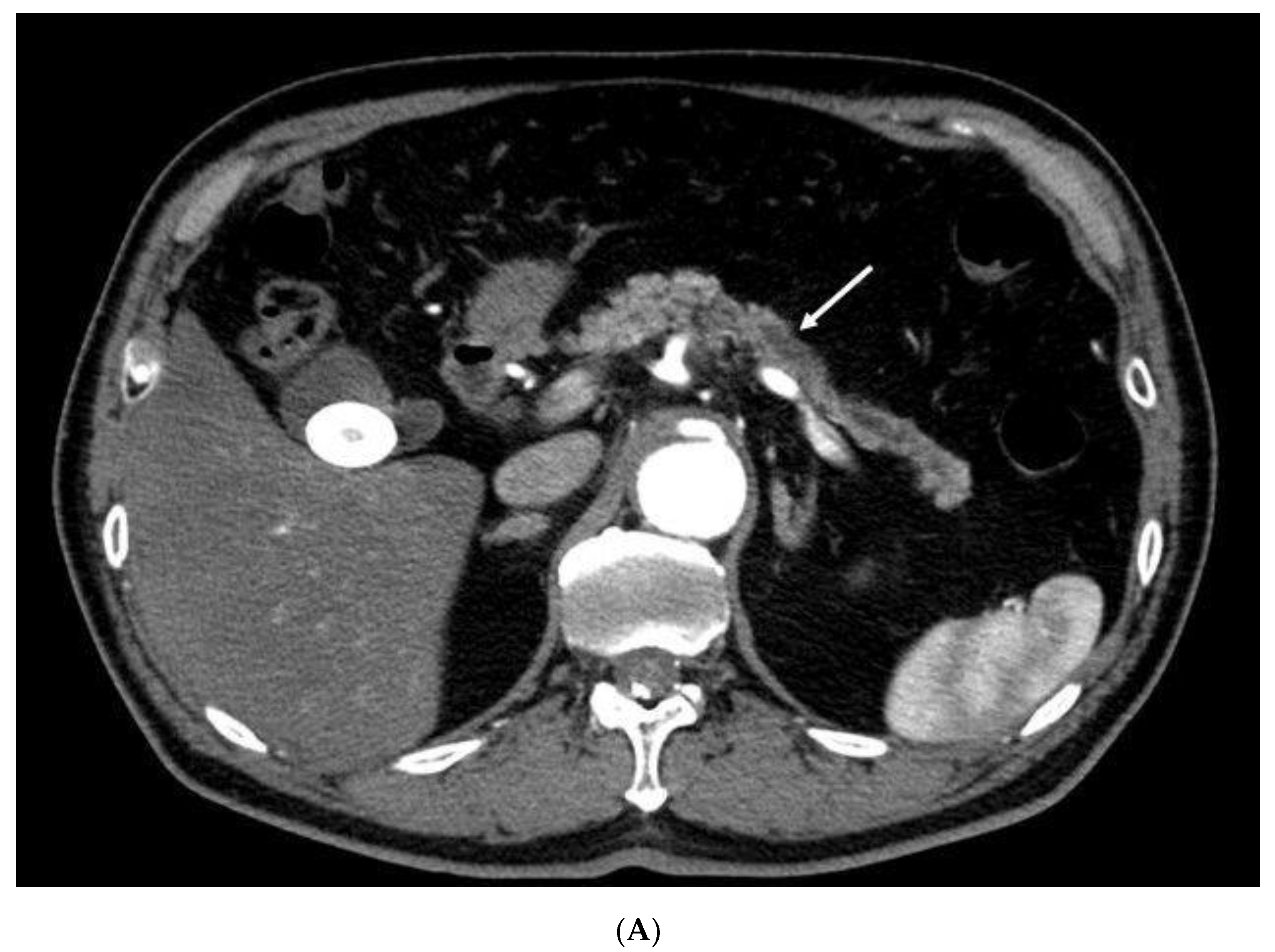 Diagnostics 10 00023 g001a