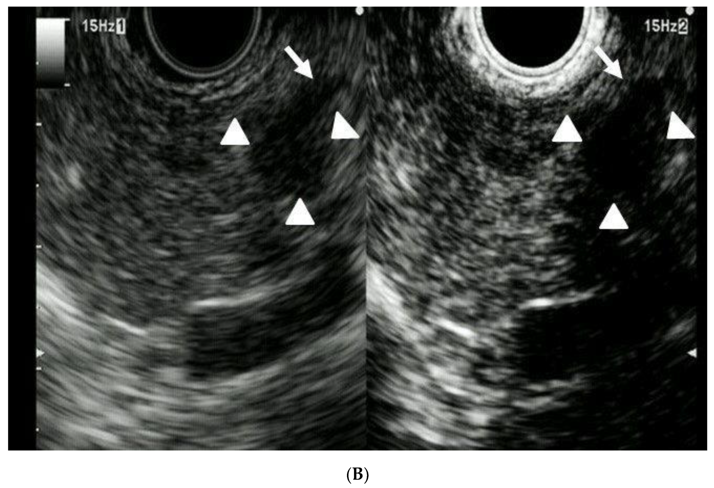 Diagnostics 10 00023 g001b