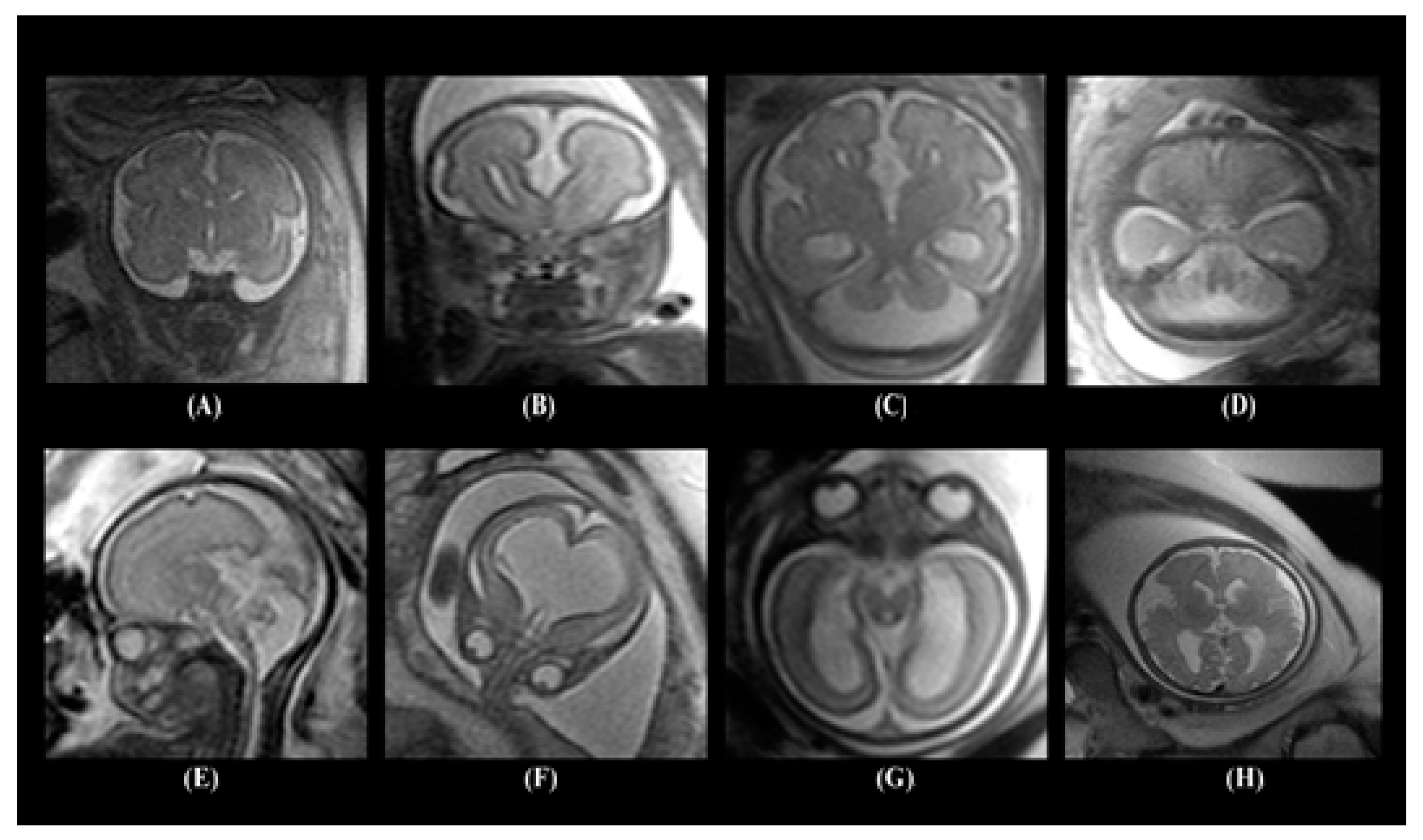 Diagnostics 10 00027 g001 Diagnostics 10 00027 g001