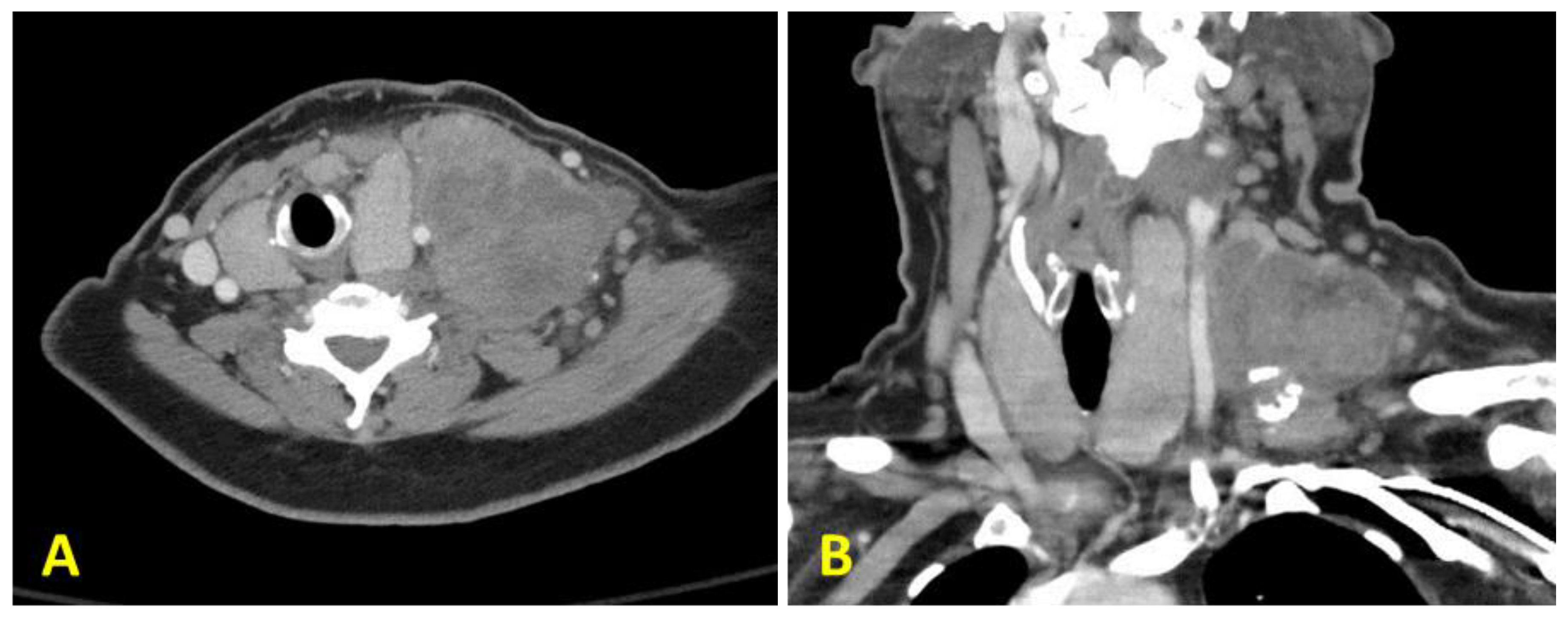 Diagnostics 10 00029 g001a