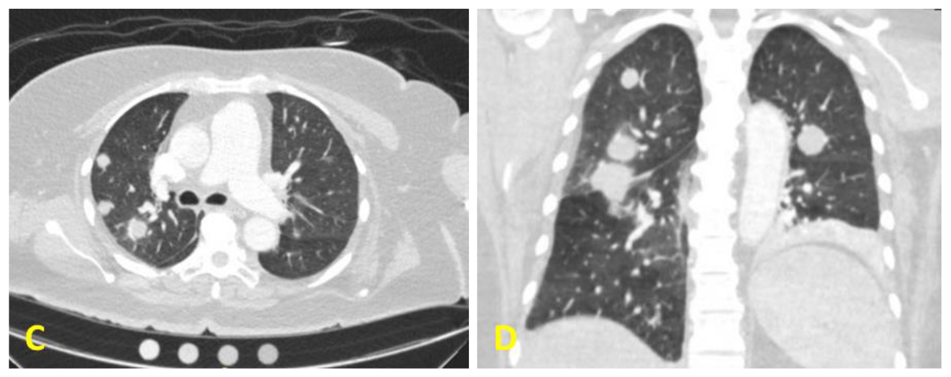Diagnostics 10 00029 g001b