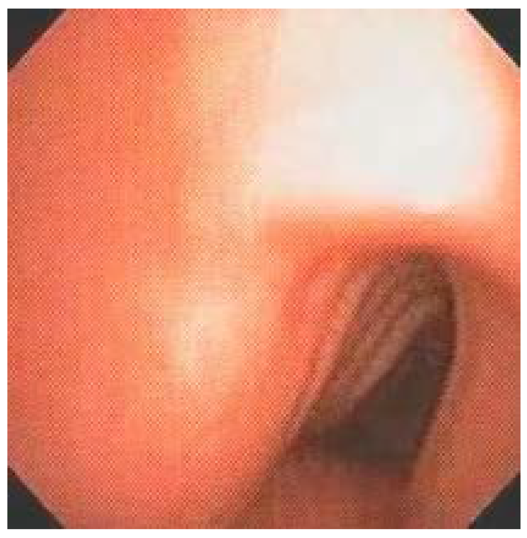 Diagnostics 10 00037 g004 Diagnostics 10 00037 g004