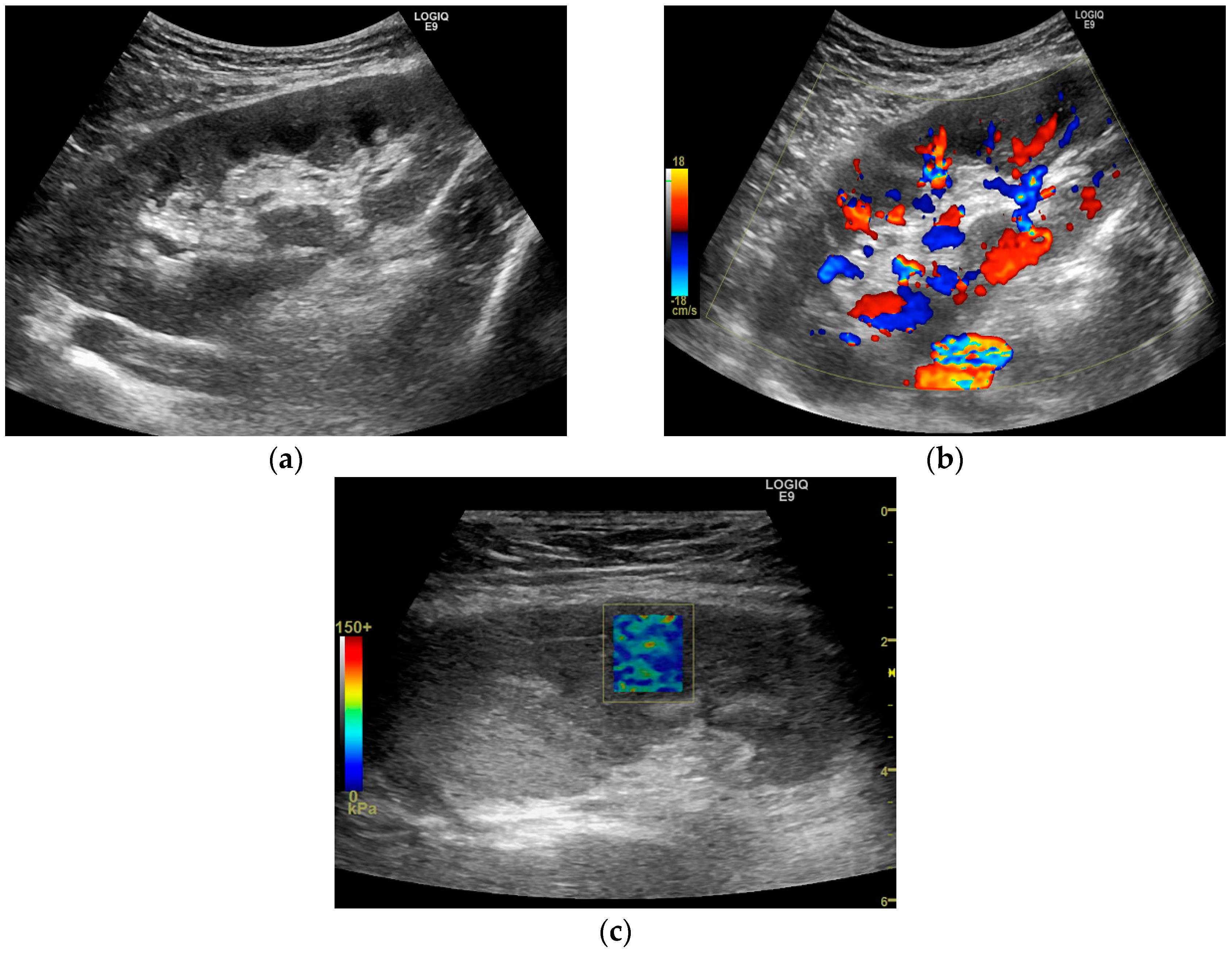 Diagnostics 10 00041 g005