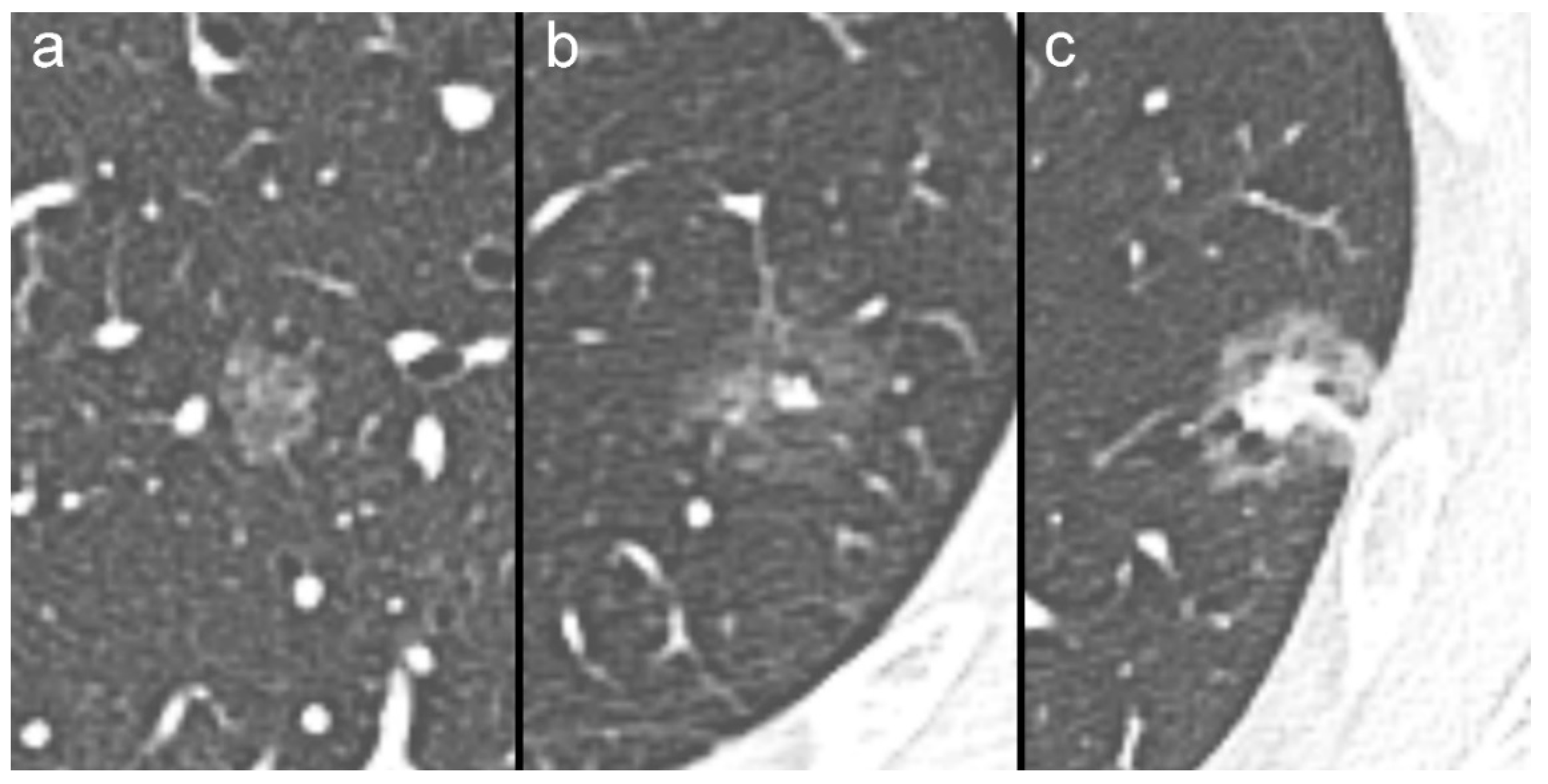 Diagnostics 10 00055 g001