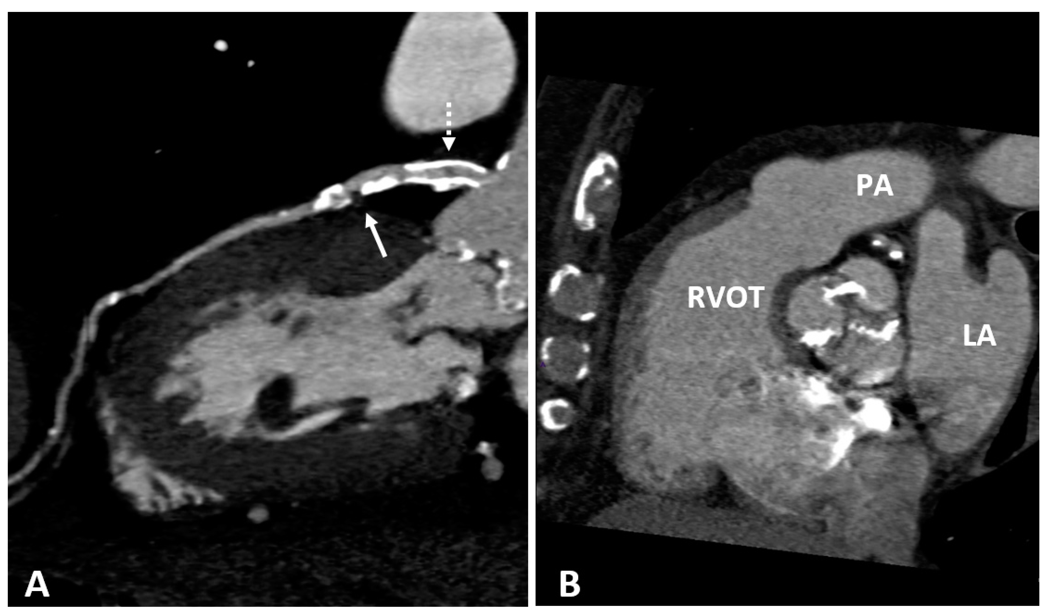 Diagnostics 10 00065 g003