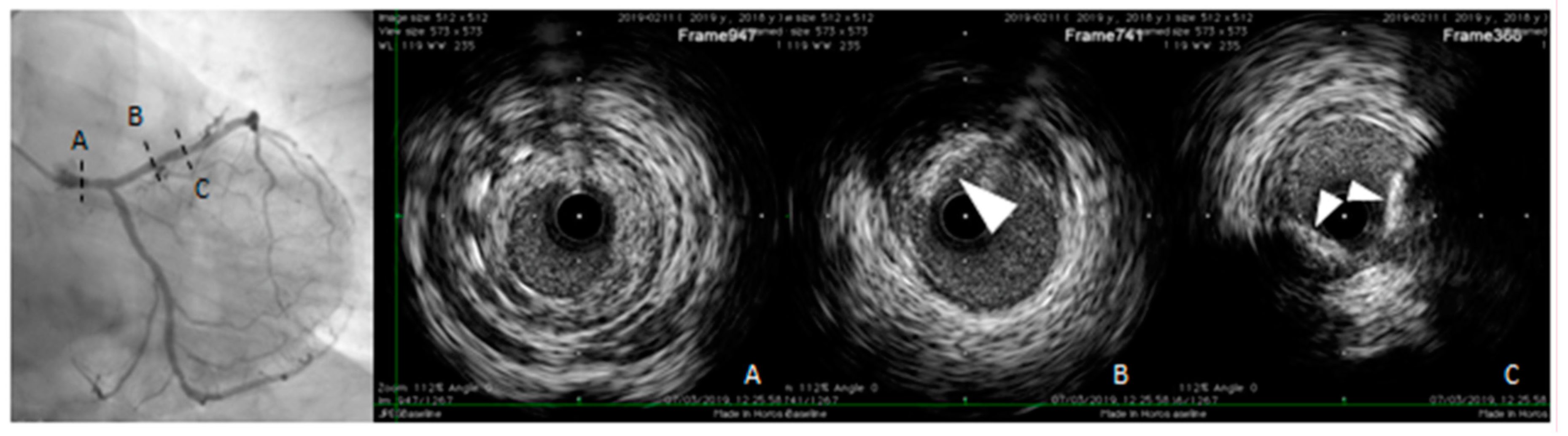 Diagnostics 10 00065 g005