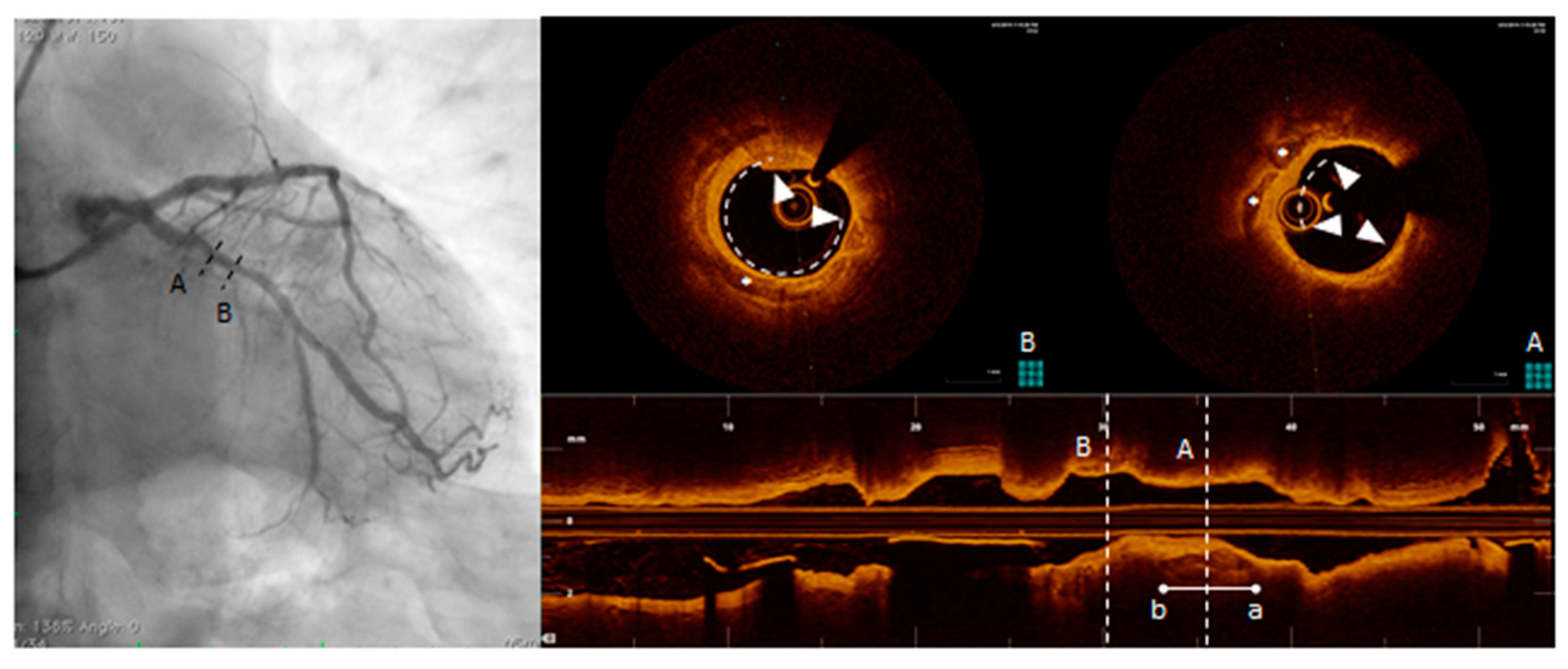 Diagnostics 10 00065 g006