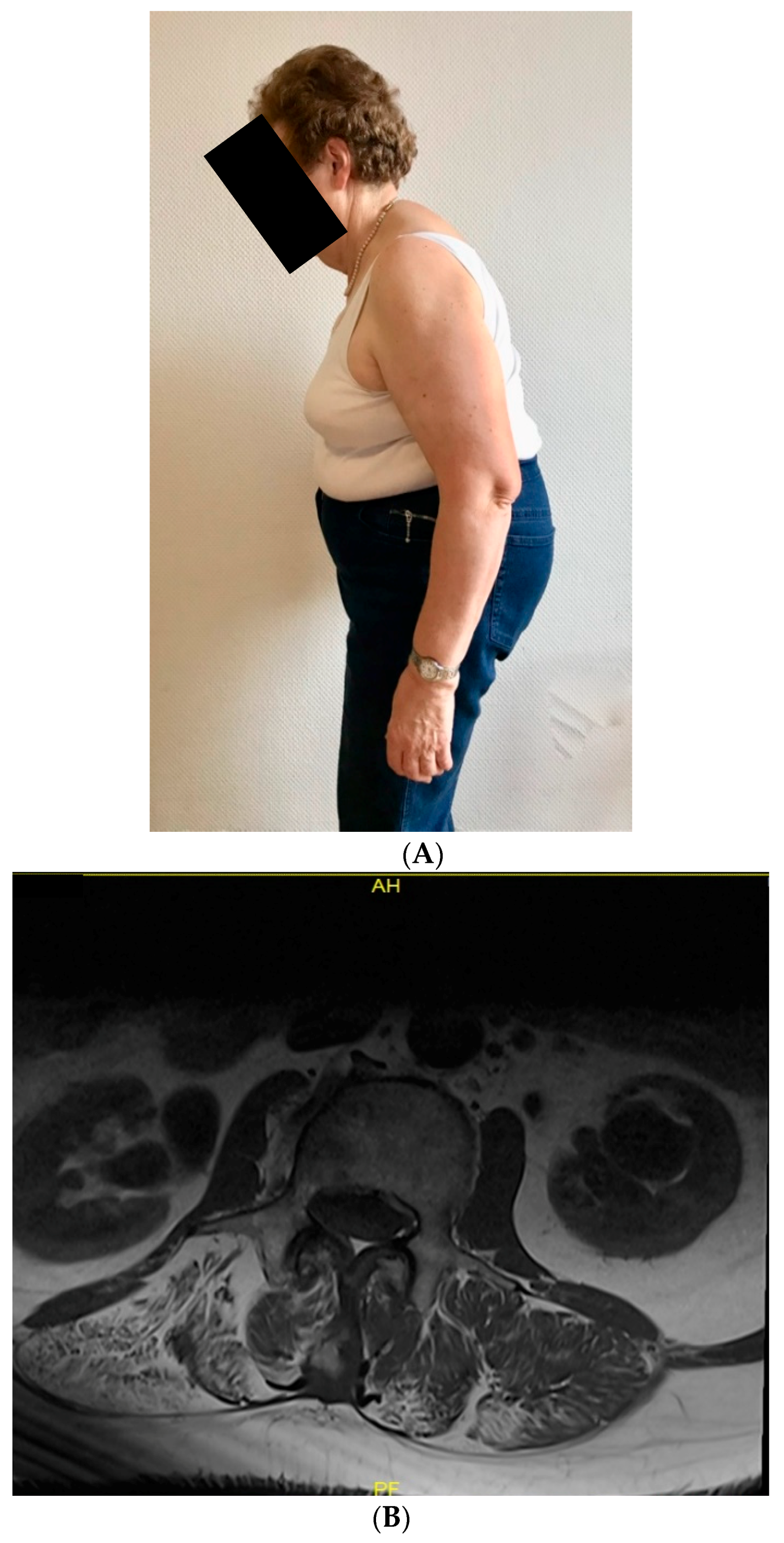 Diagnostics 10 00068 g001