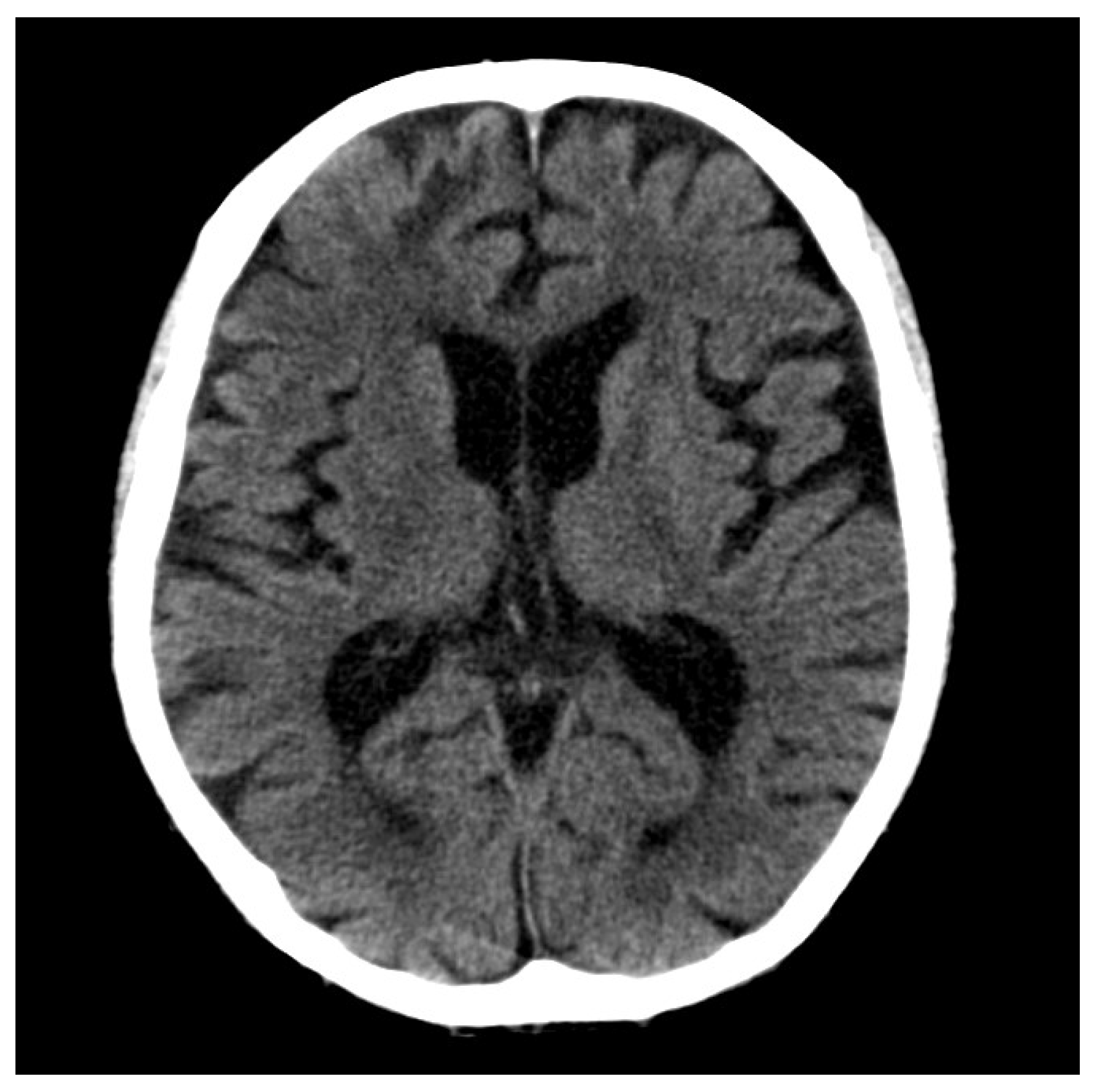 Diagnostics 10 00070 g004