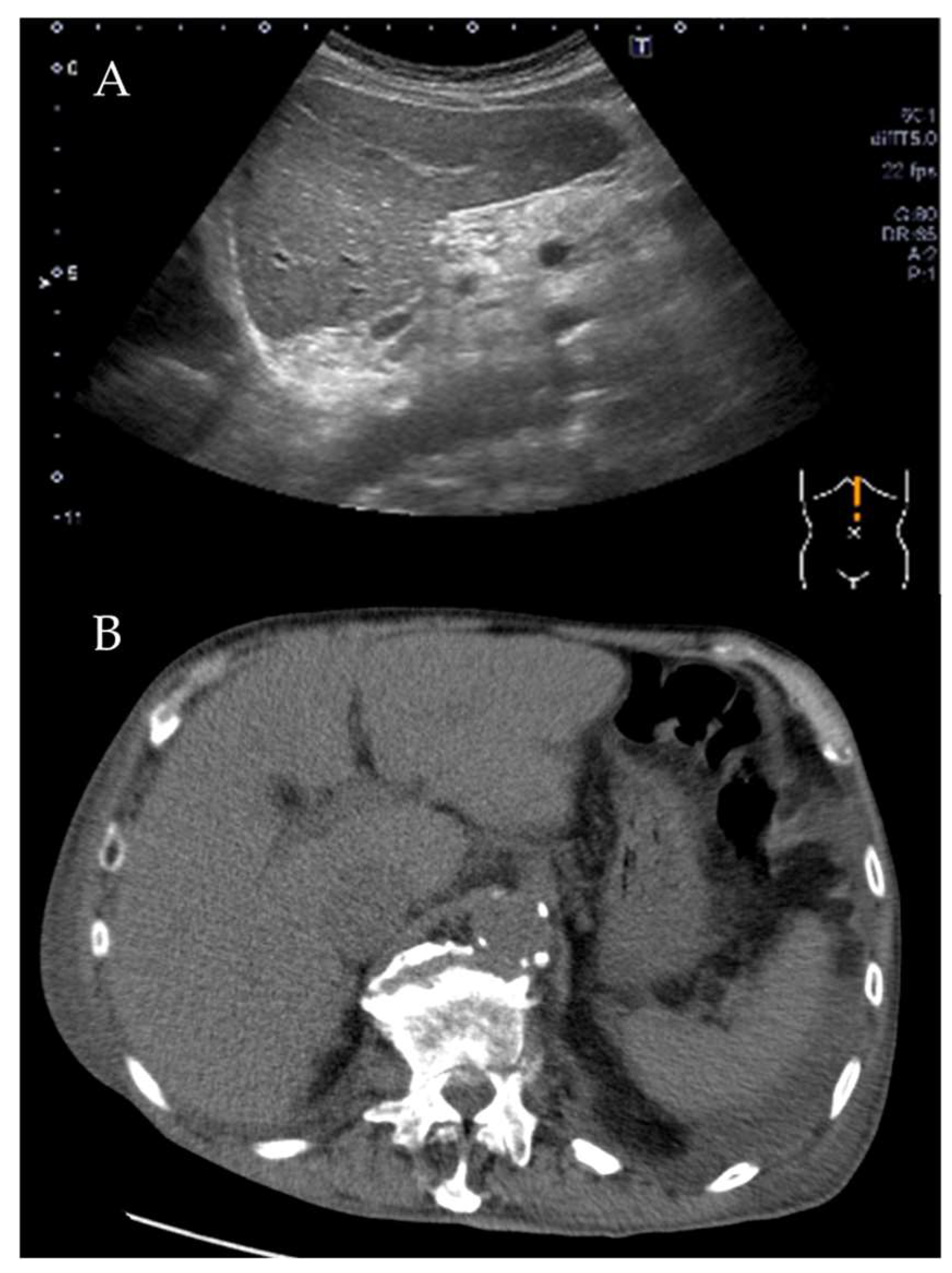 Diagnostics 10 00070 g005