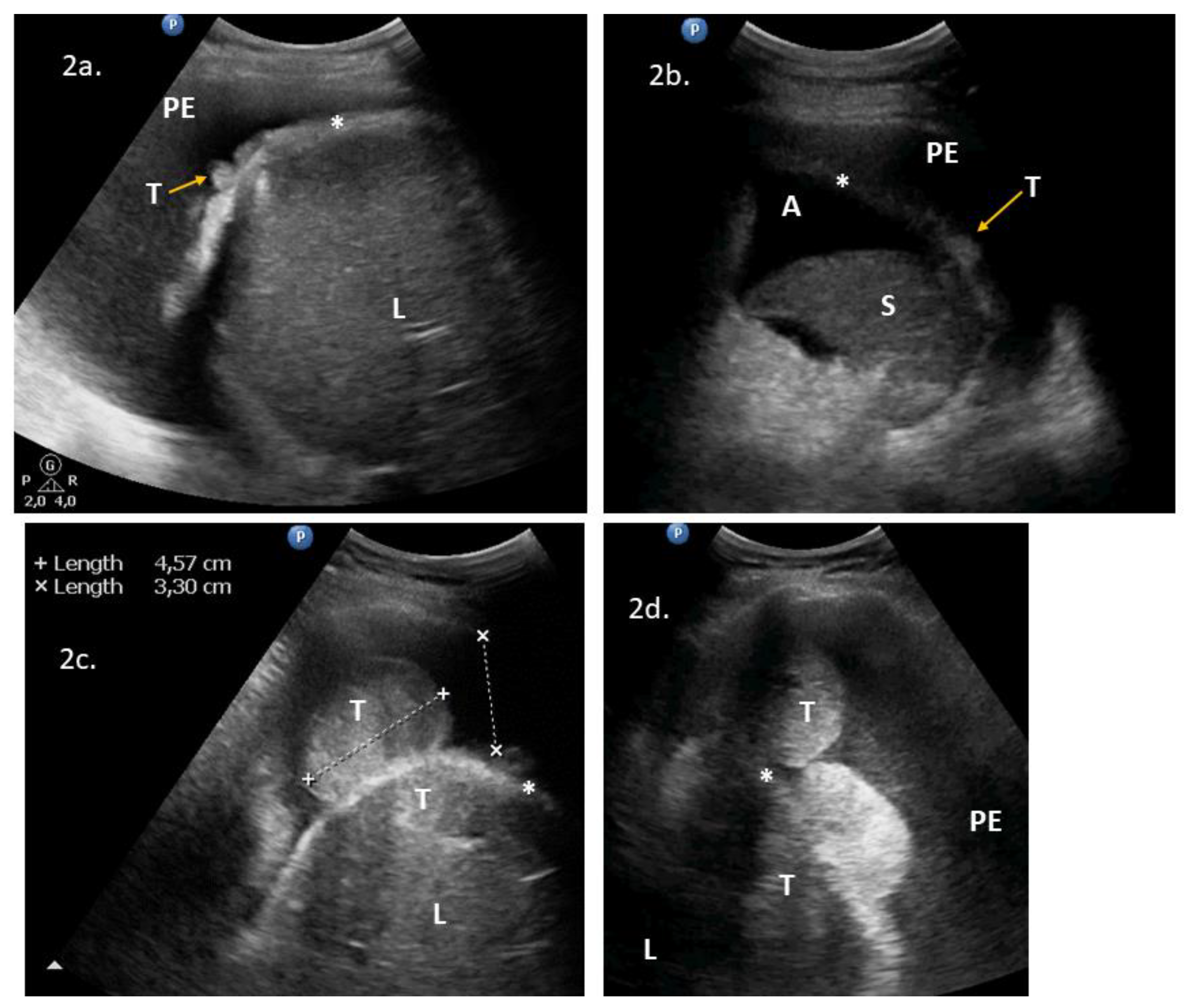 Diagnostics 10 00085 g002