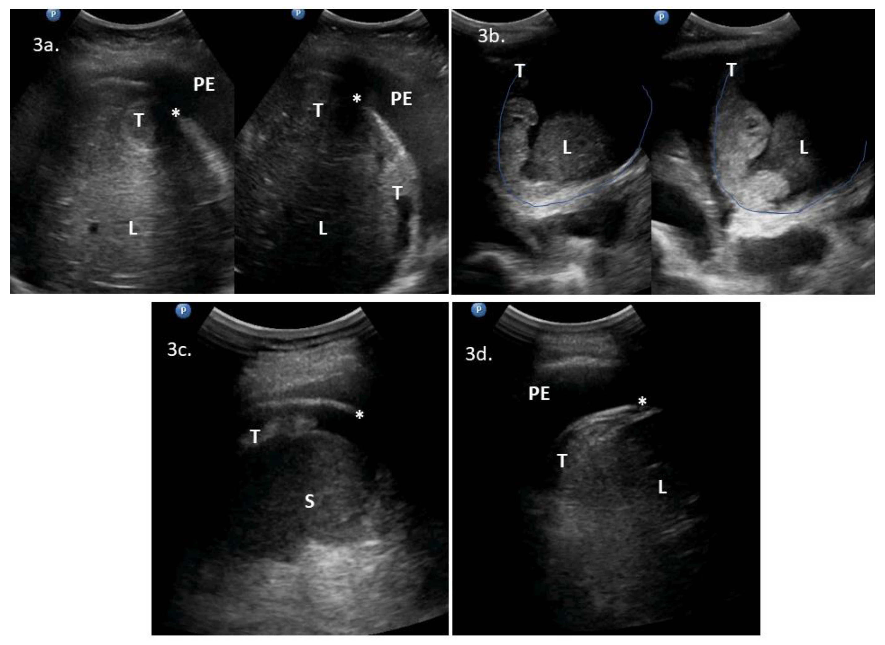 Diagnostics 10 00085 g003