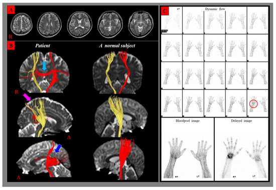 Diagnostics 10 00095 i001