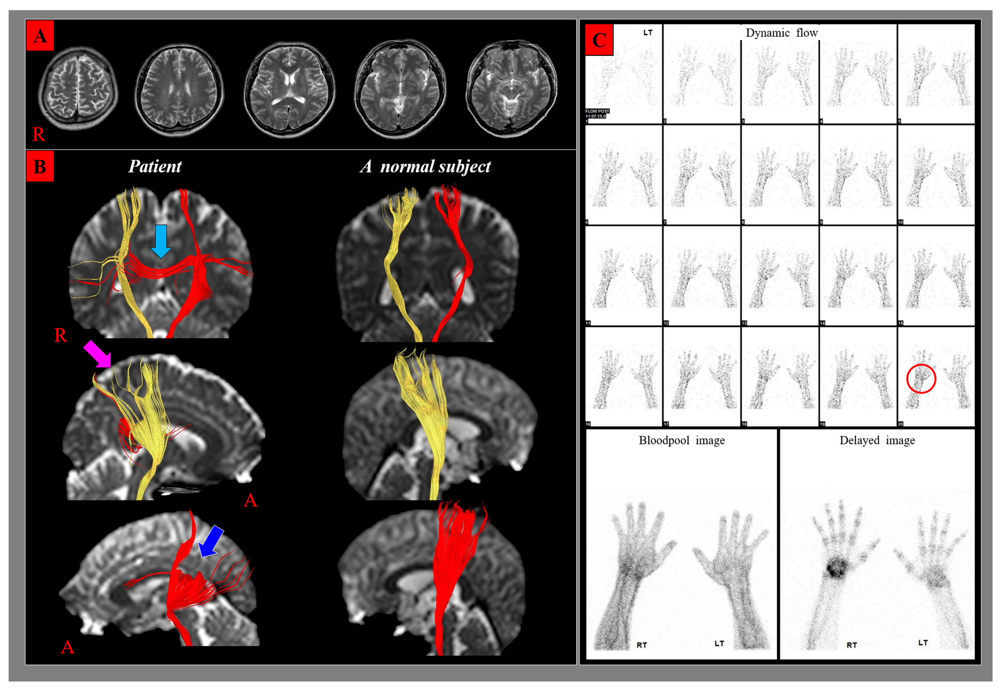 Diagnostics 10 00095 i001
