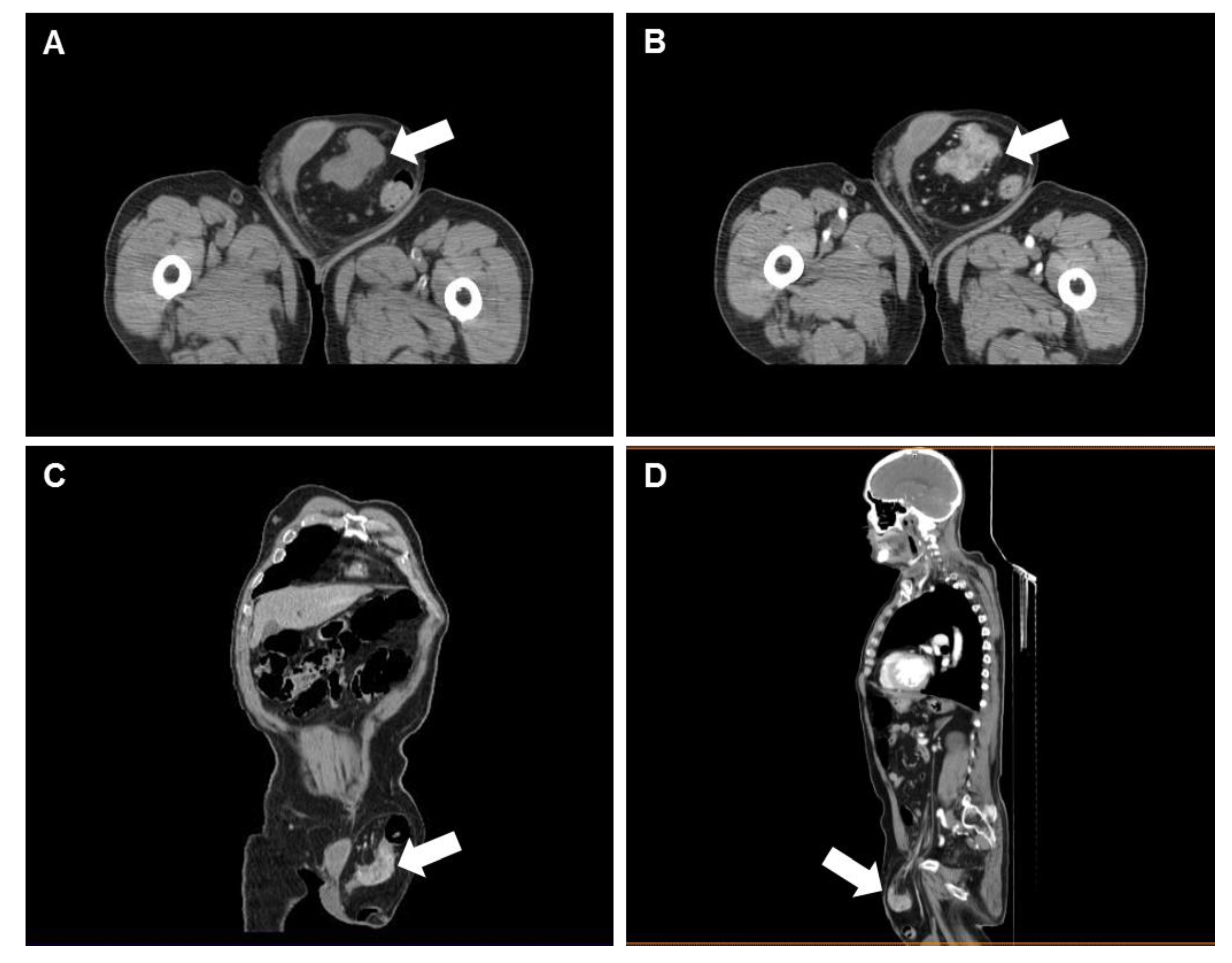 Diagnostics 10 00099 g001