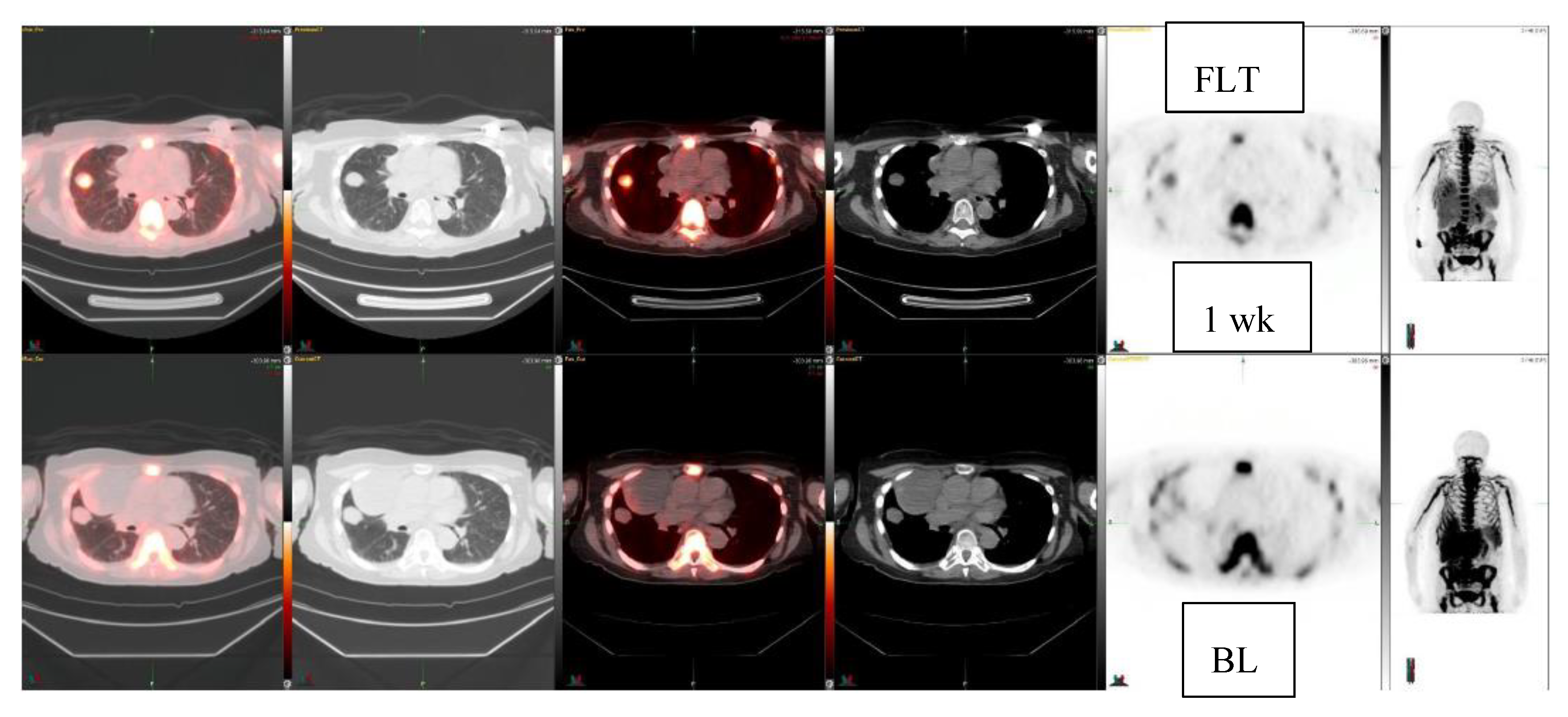 Diagnostics 10 00125 g004 Diagnostics 10 00125 g004