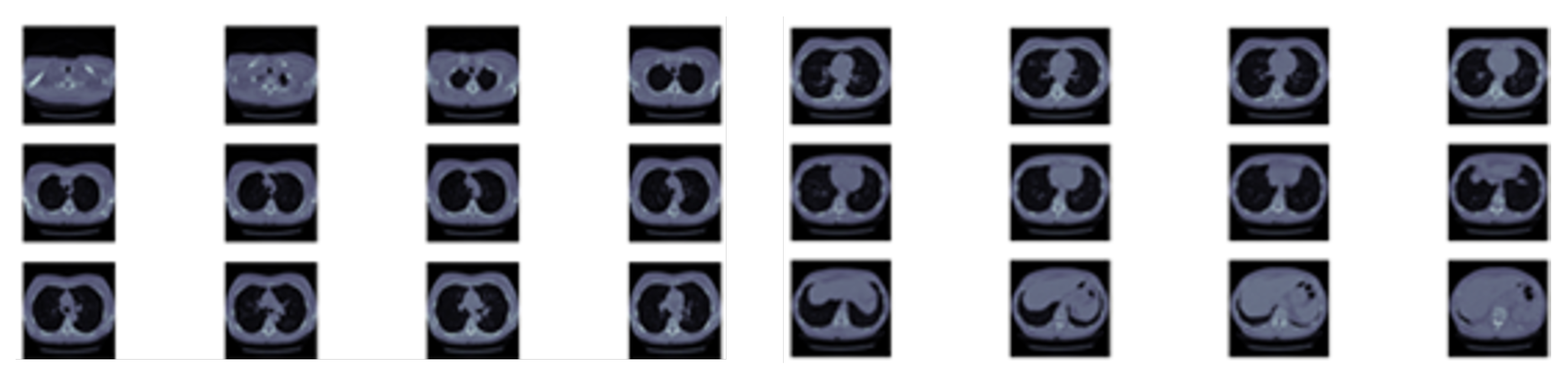 Diagnostics 10 00131 g002 Diagnostics 10 00131 g002