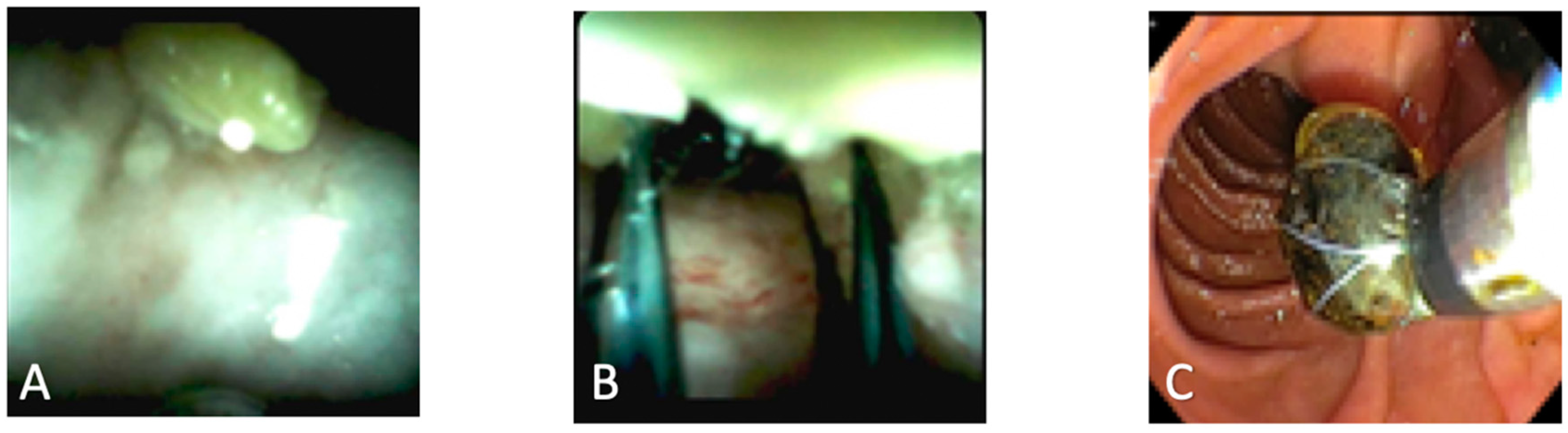 Diagnostics 10 00132 g001