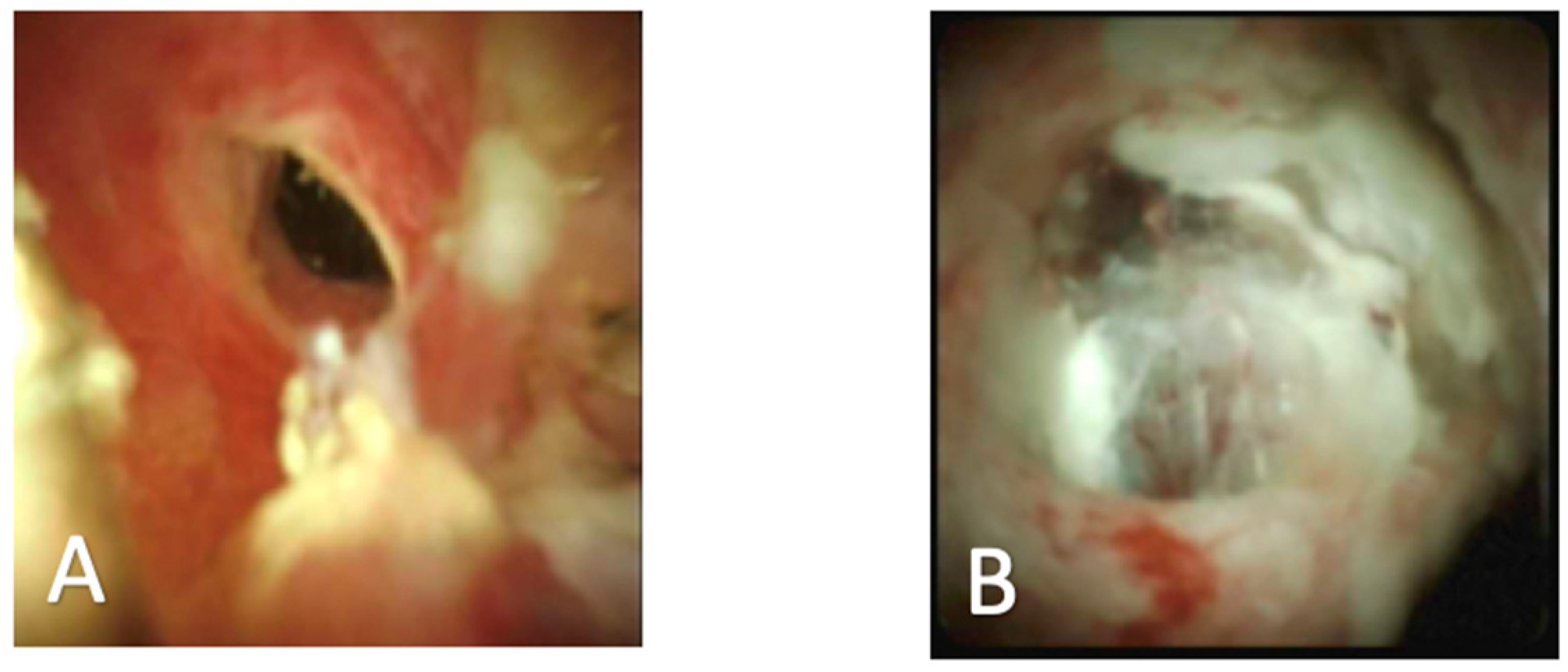 Diagnostics 10 00132 g002