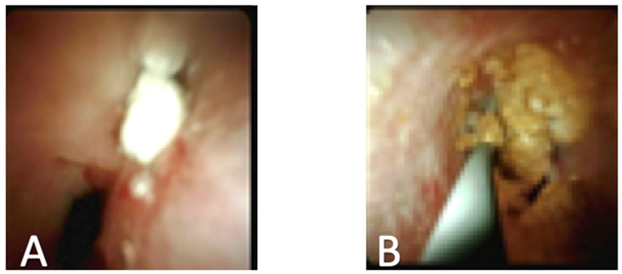 Diagnostics 10 00132 g004