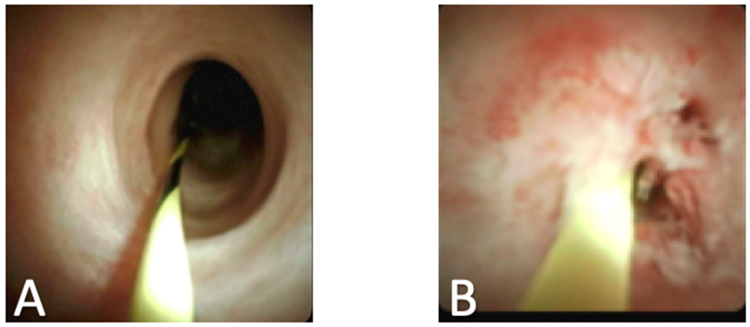 Diagnostics 10 00132 g005