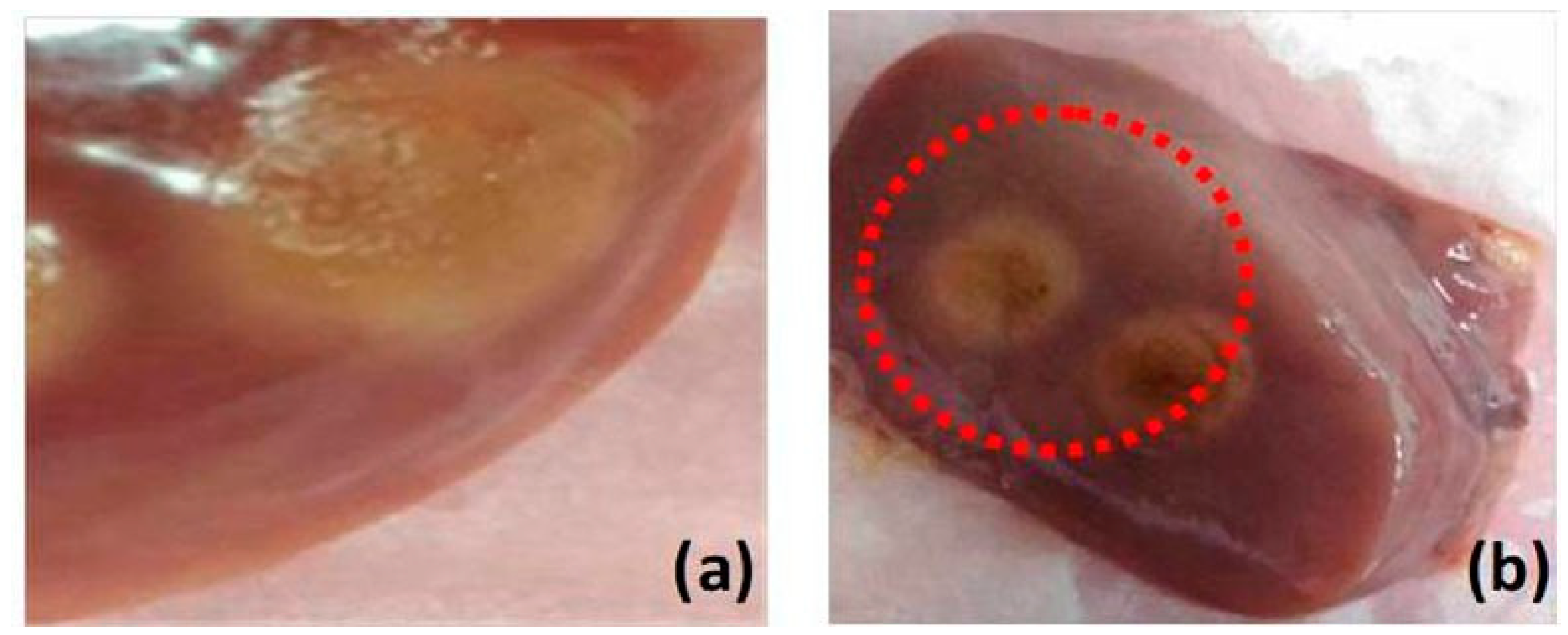 Diagnostics 10 00133 g001 Diagnostics 10 00133 g001