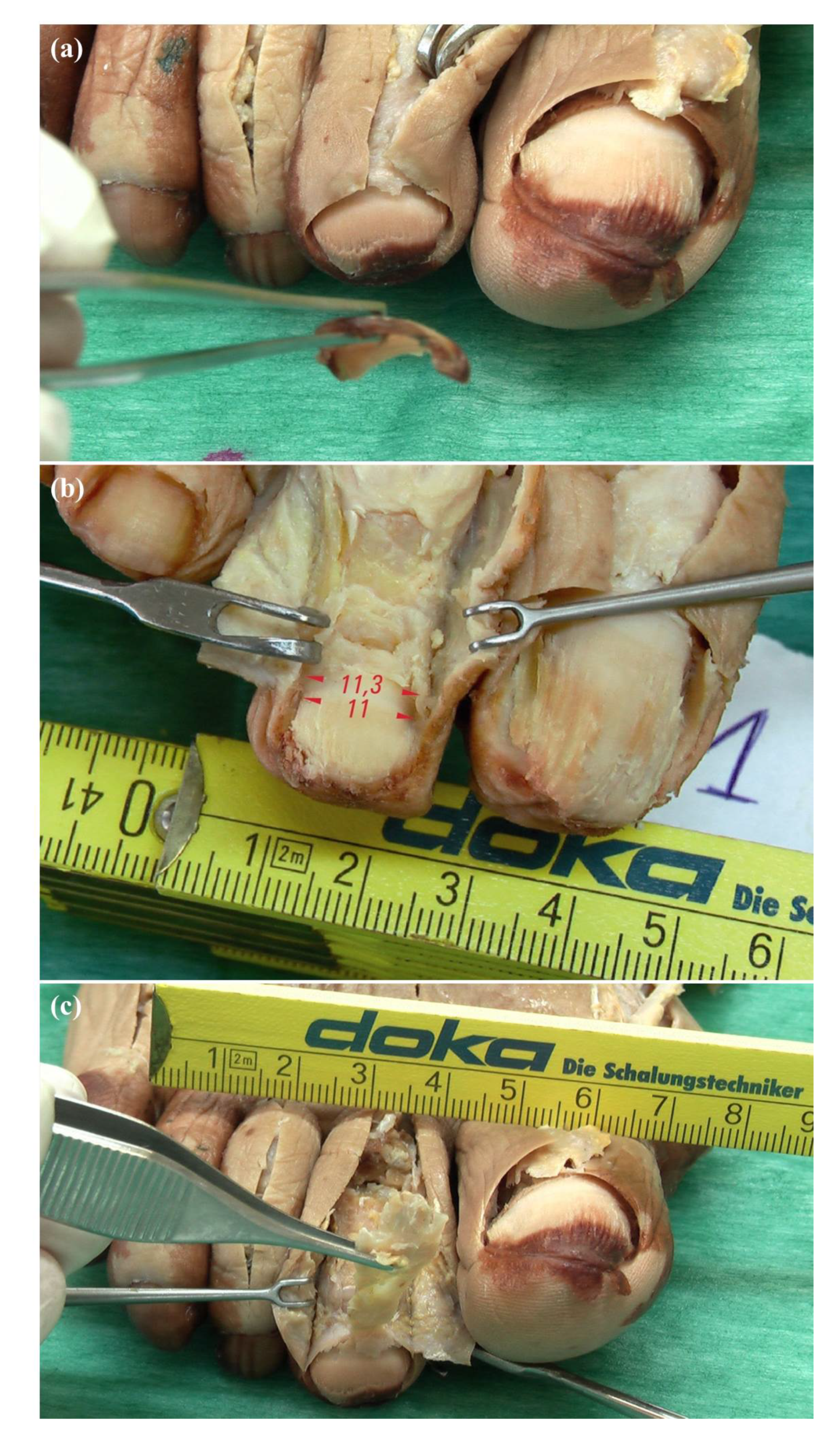 Diagnostics 10 00147 g001