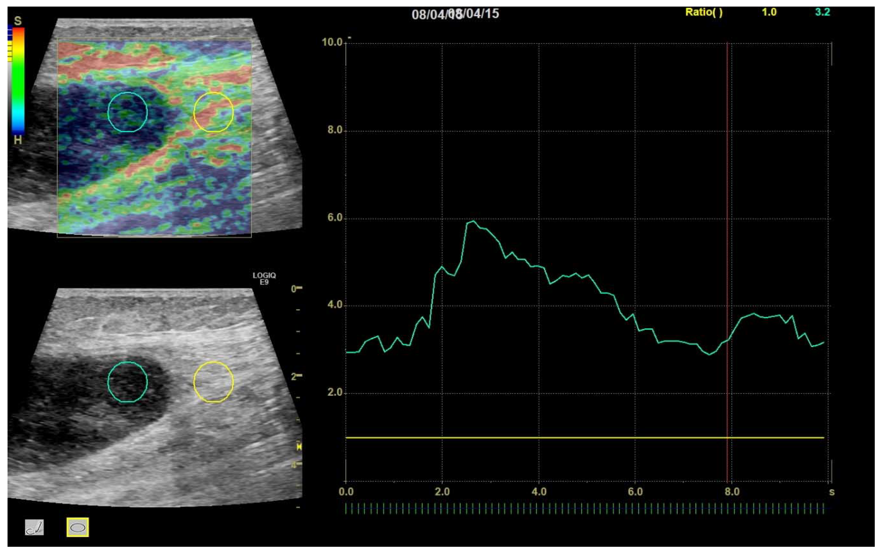 Diagnostics 10 00148 g004 Diagnostics 10 00148 g004